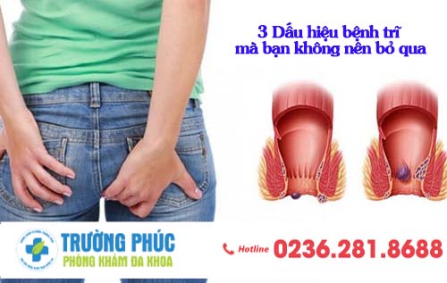 3 Dấu hiệu bệnh trĩ mà bạn không nên bỏ qua