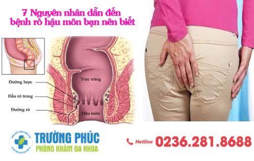 7 Nguyên nhân dẫn đến bệnh rò hậu môn bạn nên biết