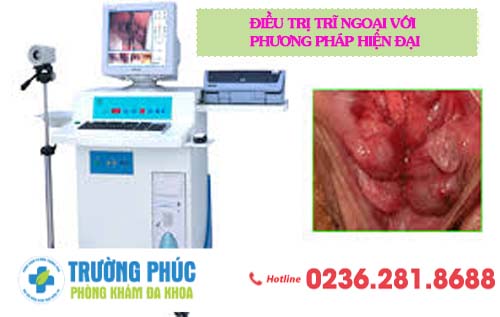 Điều Trị Trĩ Ngoại Với Phương Pháp HCPT Hiện Đại Tại Miền Trung