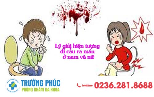 Lý giải hiện tượng đi cầu ra máu ở nam và nữ