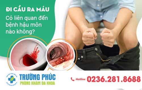 Đi cầu ra máu có liên quan đến bệnh hậu môn nào không?
