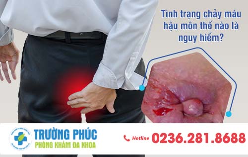 Tình trạng chảy máu hậu môn thế nào là nguy hiểm?