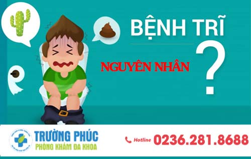4 Nguyên Nhân Chủ Yếu Gây Ra Bệnh Trĩ Nội