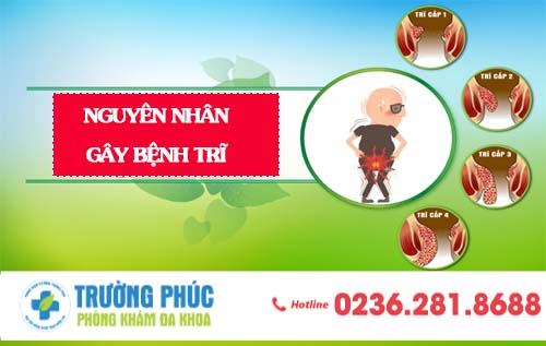 Nguyên Nhân Gây Ra Bệnh Trĩ