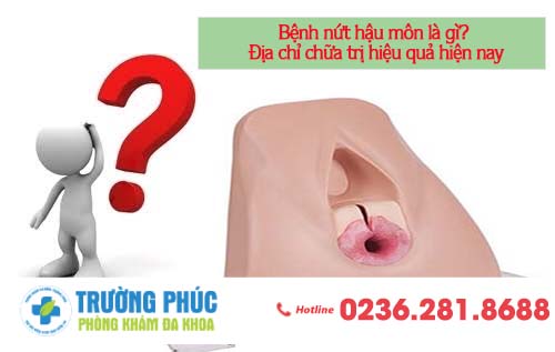 Bệnh nứt hậu môn là gì? địa chỉ chữa trị hiệu quả hiện nay