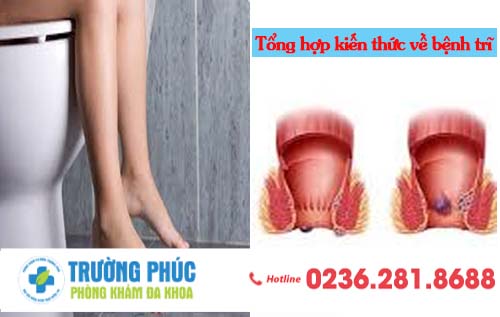 Tổng hợp kiến thức về bệnh trĩ