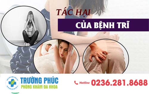 Bệnh trĩ có nguy hiểm không? tìm hiểu ngay chữa trị kẻo trễ