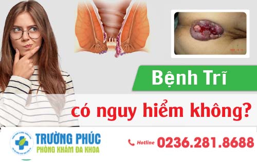 Bệnh trĩ có nguy hiểm không?