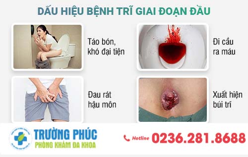 Bệnh Trĩ Giai Đoạn Đầu, Dấu Hiệu Và Cách Điều Trị Hiệu Quả