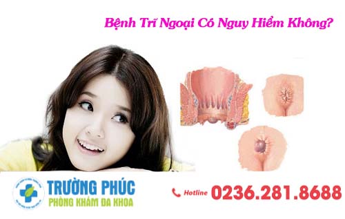 Bệnh Trĩ Ngoại Có Nguy Hiểm Không?