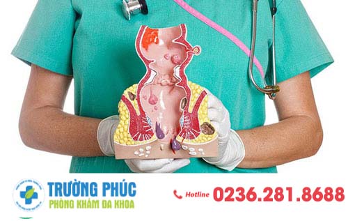 Chữa trĩ hiệu quả chỉ sau một lần trị