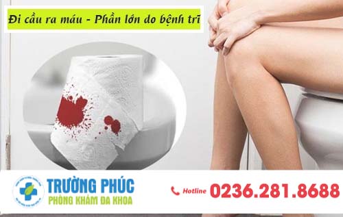 Đi cầu ra máu – không đơn giản chỉ là bị táo bón