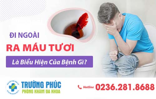 Lý giải hiện tượng đi ngoài ra máu