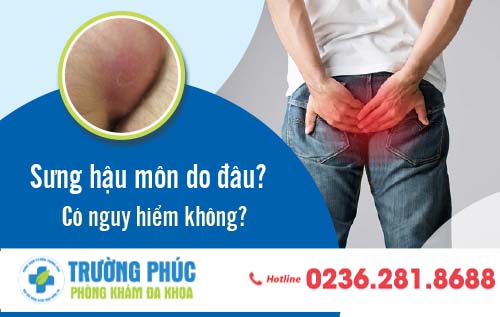 Bị sưng hậu môn là do đâu?