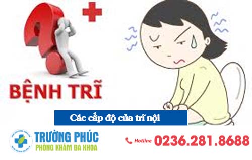 Các cấp độ của bệnh trĩ nội người bệnh nên biết