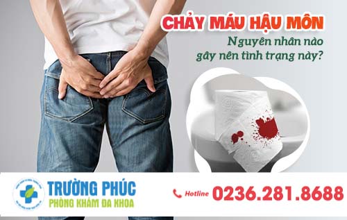 Chảy máu hậu môn - Nguyên nhân nào gây nên tình trạng này?