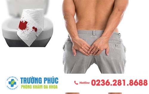 Những khuyến cáo của bác sĩ từ triệu chứng đại tiện ra máu