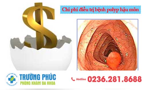 Chi phí điều trị bệnh polyp hậu môn tại Đà Nẵng hết bao nhiêu tiền?