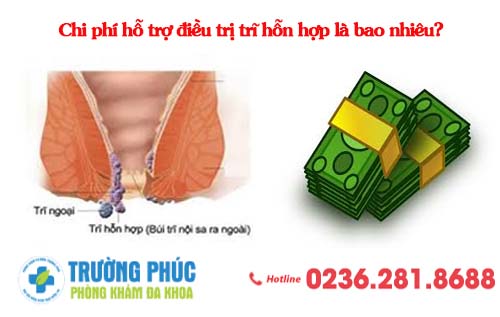 Chi phí hỗ trợ điều trị trĩ hỗn hợp là bao nhiêu?