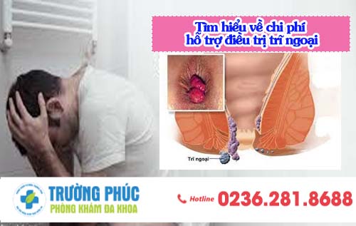 Tìm hiểu về chi phí hỗ trợ điều trị trĩ ngoại