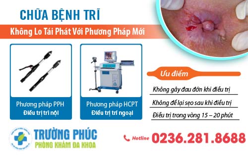 Cách chữa bệnh trĩ không tái phát nhiều người đã áp dụng thành công