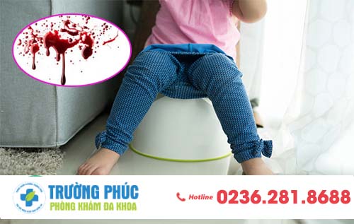 Vì sao bạn đi cầu ra máu?