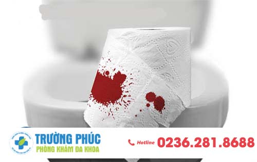 Hỏi đáp Bác sĩ: Tự nhiên đại tiện ra máu thì có sao không?
