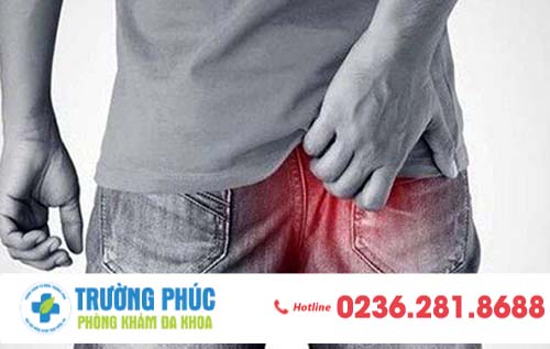 Ngứa hậu môn - Biểu hiện bệnh hậu môn nguy hiểm