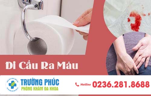 Chữa đi cầu ra máu ở đâu hiệu quả?