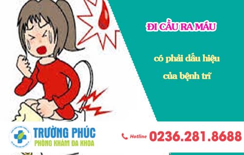 Đi cầu ra máu có phải là dấu hiệu của bệnh trĩ ?