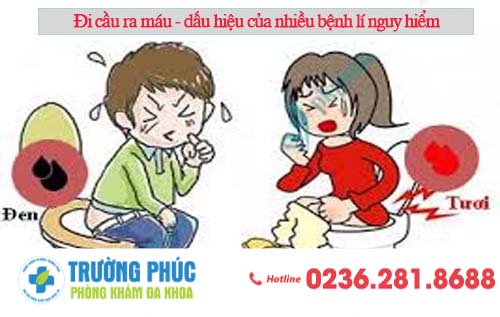 Đi cầu ra máu – biểu hiện của nhiều bệnh lí nguy hiểm