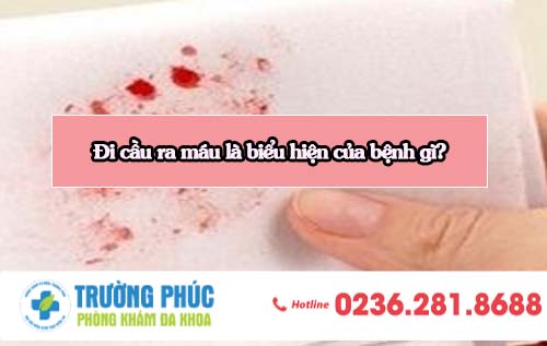 Đi cầu ra máu là biểu hiện của bệnh gì?