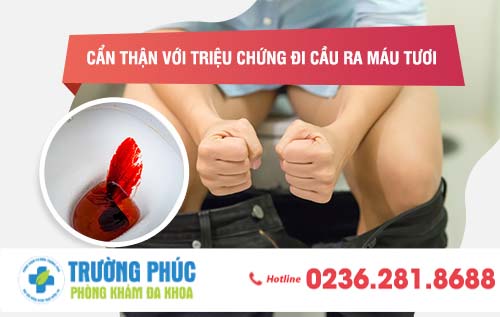 Đi cầu ra máu tươi triệu chứng bệnh hậu môn, trực tràng
