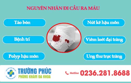 Nguyên nhân đi cầu ra máu và cách chữa trị hiệu quả nhất