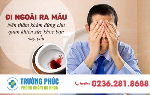 Đi ngoài ra máu – dấu hiệu sớm của bệnh trĩ