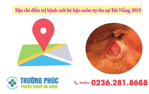 Địa chỉ điều trị bệnh nứt kẻ hậu môn uy tín tại Đà Nẵng 2020