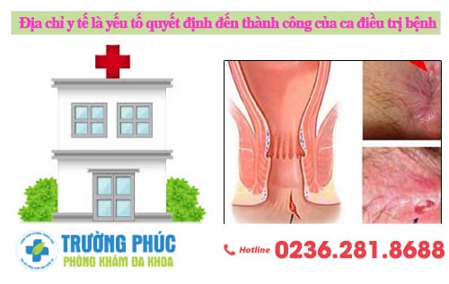 Địa chỉ y tế là yếu tố ảnh hưởng đến kết quả điều trị nứt hậu môn