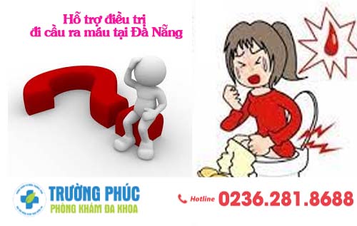Hỗ trợ điều trị đi cầu ra máu tại Đà Nẵng