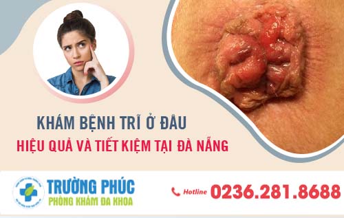 Khám bệnh trĩ ở đâu hiệu quả và tiết kiệm tại Đà Nẵng