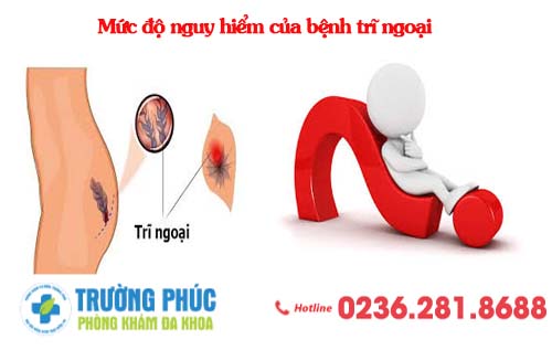 Mức độ nguy hiểm của bệnh trĩ ngoại