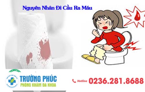 Nguyên Nhân Đi Cầu Ra Máu