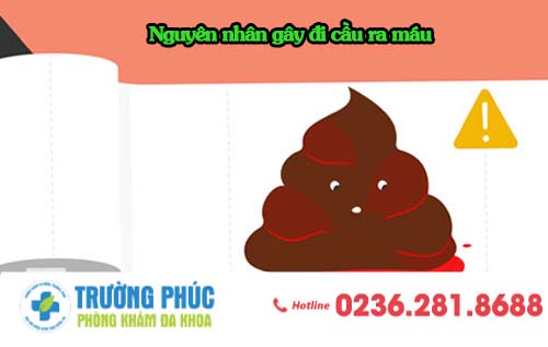 Nguyên nhân gây đi cầu ra máu