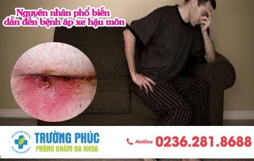 5 nguyên nhân phổ biến dẫn đến bệnh áp xe hậu môn