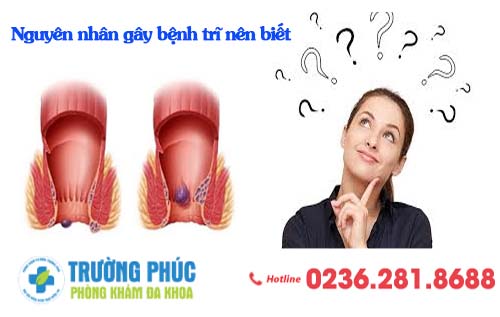 Nguyên nhân gây bệnh trĩ nên biết