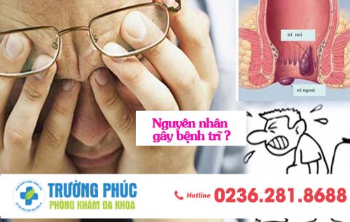 Những nguyên nhân nào khiến bạn mắc bệnh trĩ ?