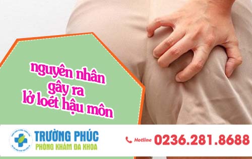 Nguyên Nhân Gây Lỡ Loét Hậu Môn