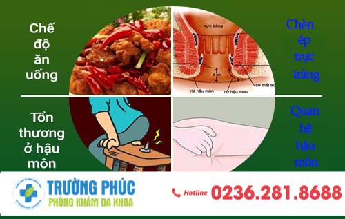 Biểu hiện nào cho thấy bạn bị loét hậu môn ?
