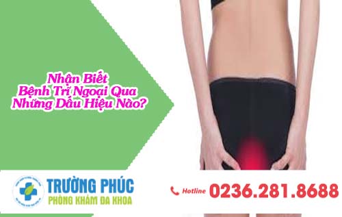 Nhận Biết Bệnh Trĩ Ngoại Qua Những Dấu Hiệu Nào?