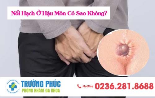 Nổi Hạch Ở Hậu Môn Có Sao Không?