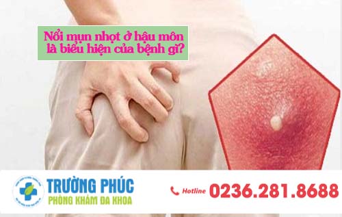 Nổi mụn nhọt ở hậu môn là biểu hiện của bệnh gì?